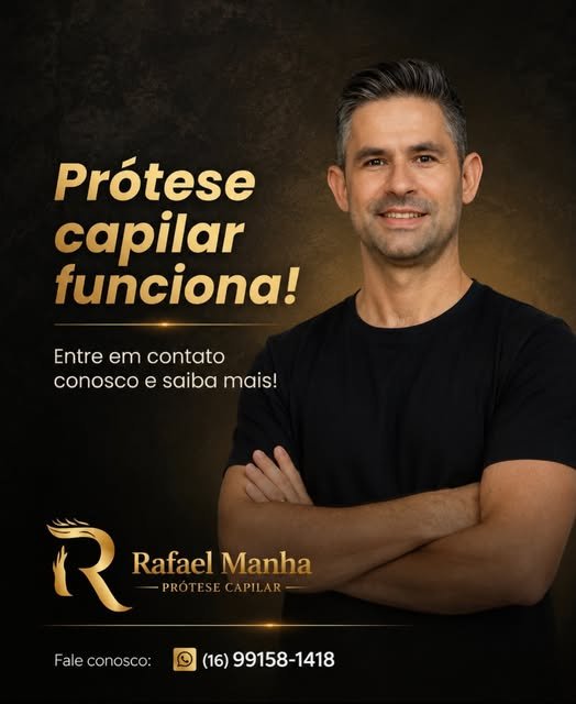 Prótese capilar em publicação de Rafael Manha